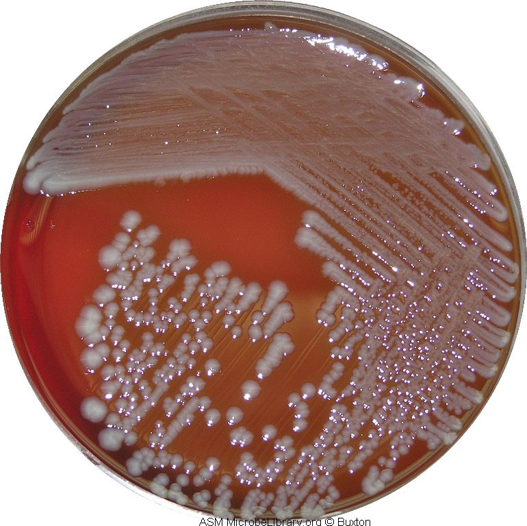 Coli sotwe. Escherichia coli колонии. Агар Левина эшерихии. Эшерихии коли микробиология.